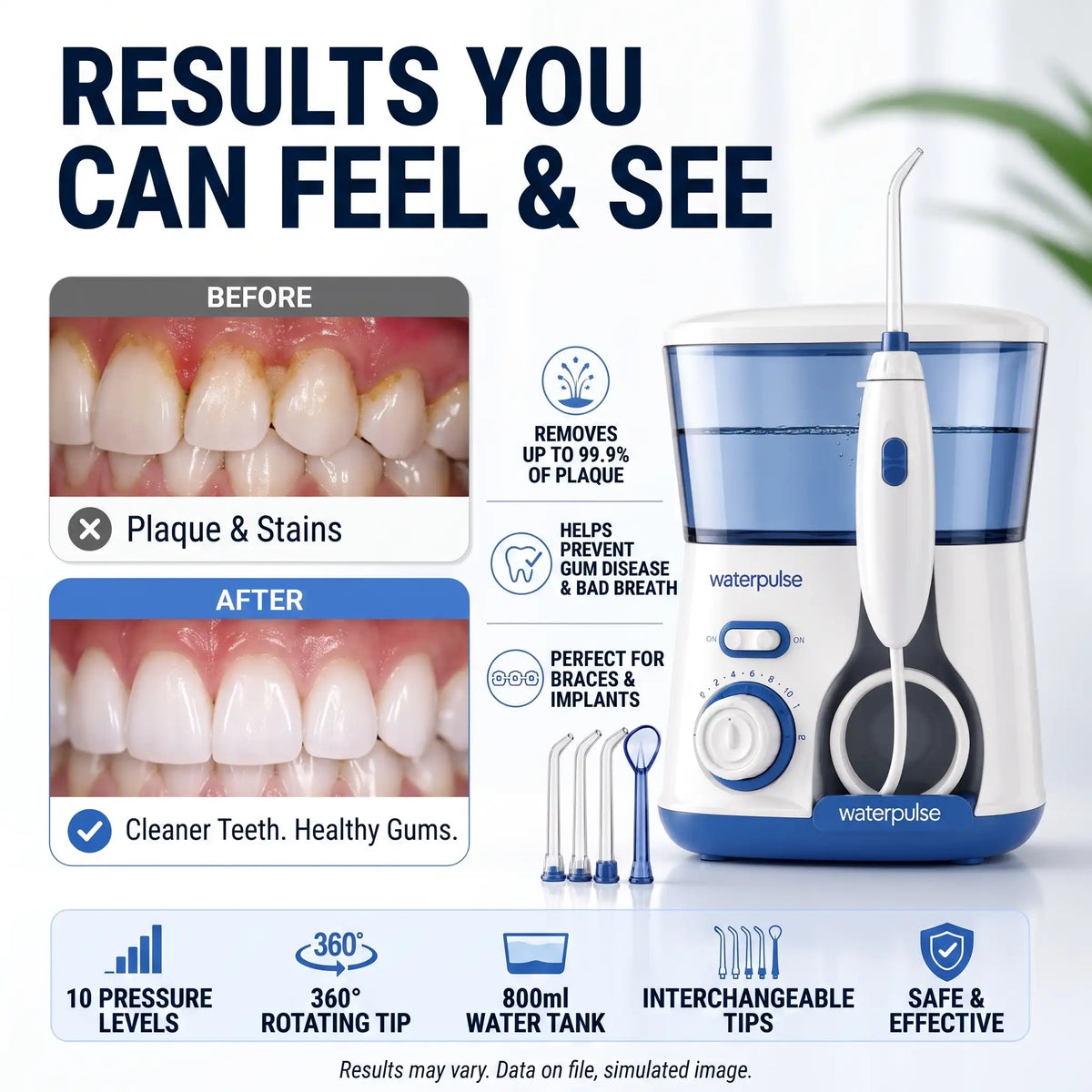 Professional Dental Water Flosser - Orthilife™