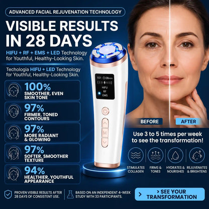 At-Home HIFU Facial Lifting Device - Orthilife™