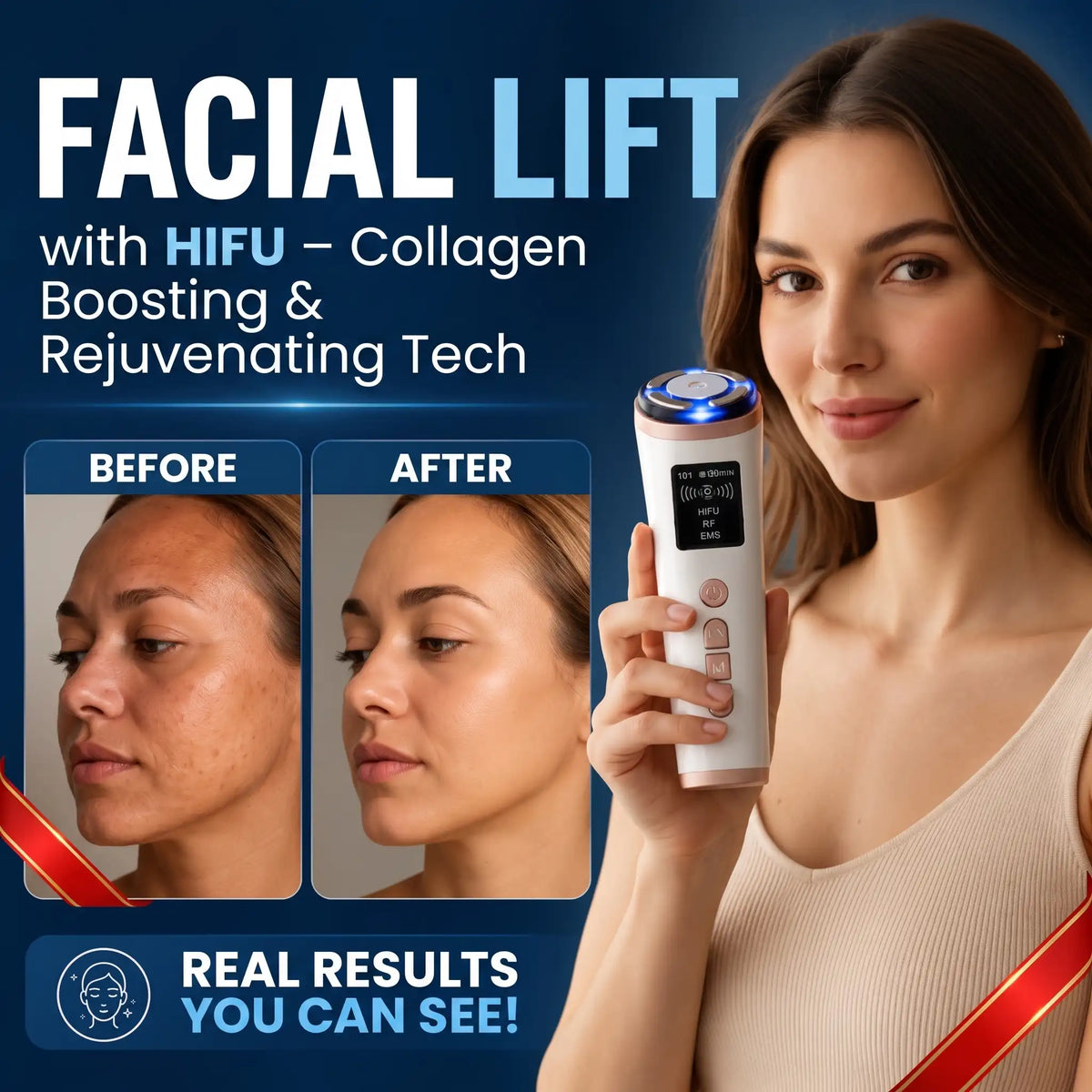 At-Home HIFU Facial Lifting Device - Orthilife™