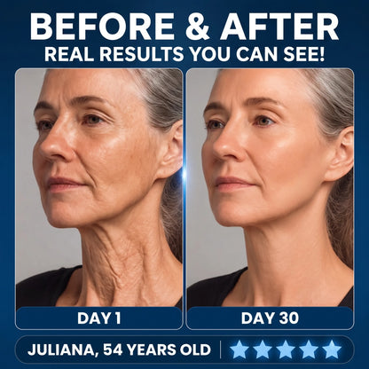 At-Home HIFU Facial Lifting Device - Orthilife™