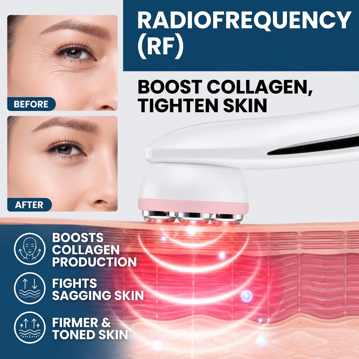 5-in-1 RF & LED Facial Massager - Orthilife™