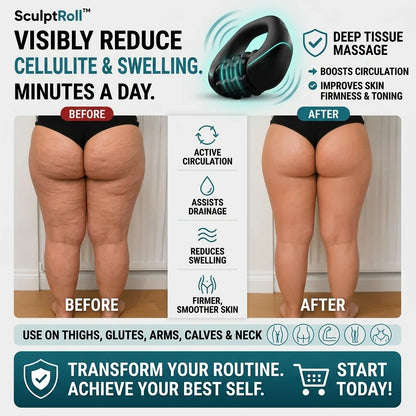 Anti-Cellulite & Lymphatic Drainage Massage Roller - SculptRoll™ - Orthilife™